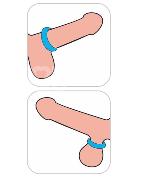 Cockring Ridge Bump Stretcher 25 mm Bleu