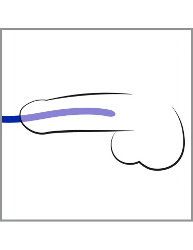 Lot de 3 tiges d'urètre silicone Bleues 16cm - Diamètre 7-12mm