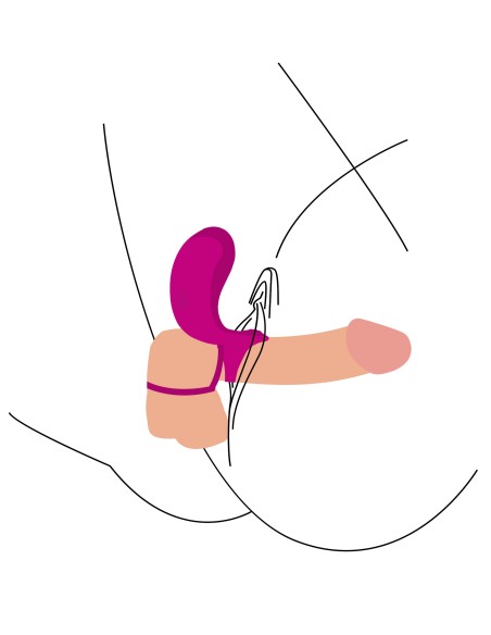 Cockring vibrant Annel Stim 30mm