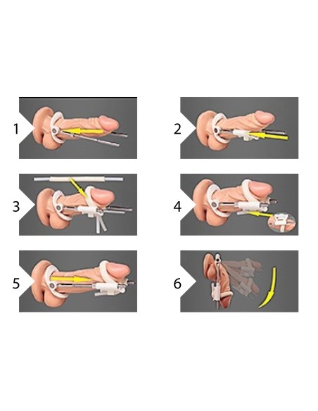 Extenseur de pénis mécanique Blanc