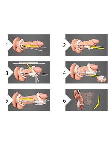 Extenseur de pénis Noir