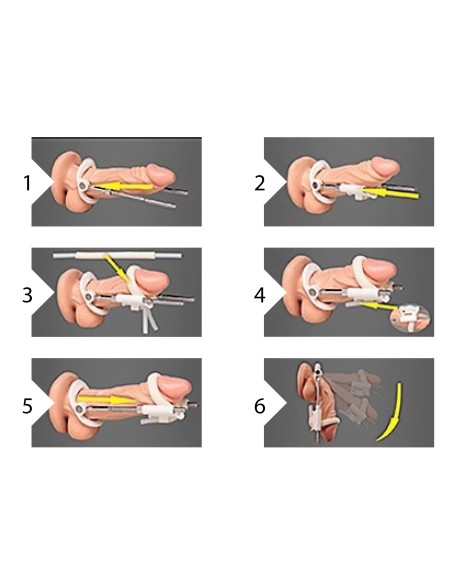 Extenseur de pénis Noir